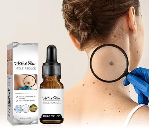 مزيل علامات الشامات من حمض الساليسيليك للوجه والجسم، مصل إزالة الثآليل مع قطارة دقيقة، إزالة الثآليل والشامات سريعة المفعول للثآليل الأخمصية والشائعة والمسطحة، تركيبة لطيفة (قطعتان) in Saudi Arabia