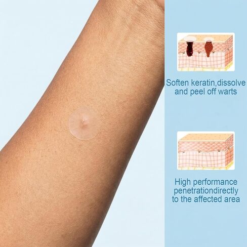 Wart Remover Patches, Fast & Easy Operate Hydrocolloid Waterproof Invisible Sticker, Suitable for All Skin, Friendly to New-User, 144Pcs in Kuwait