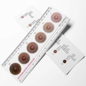 Breast Cancer Fitzpatrick Scale Areola Color Ruler in Saudi Arabia