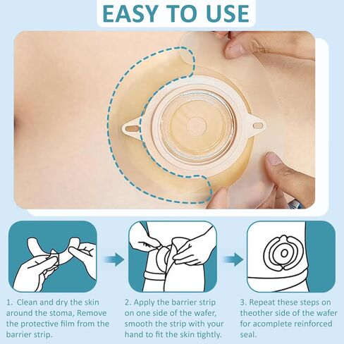 20PCS Ostomy Barrier Strips, Elastic Hydrocolloid Skin Barrier Tape for Colostomy & Ileostomy Care – Universal Ostomy Supplies for Secure Seal & Leak Prevention in Saudi Arabia