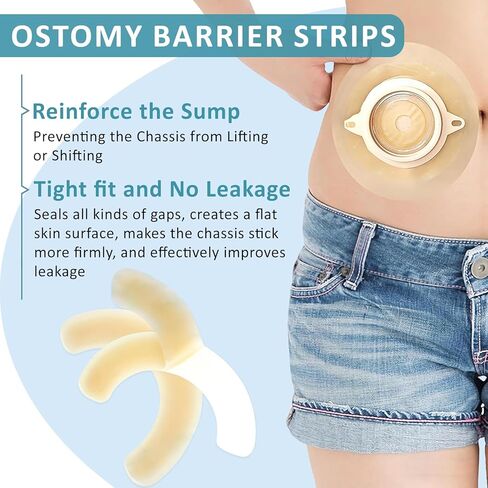 20PCS Ostomy Barrier Strips, Elastic Hydrocolloid Skin Barrier Tape for Colostomy & Ileostomy Care – Universal Ostomy Supplies for Secure Seal & Leak Prevention in Saudi Arabia
