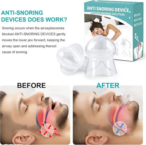 Anti Snoring Device - Snoring Solution Mouth Guard for Men and Women -F04 in Kuwait