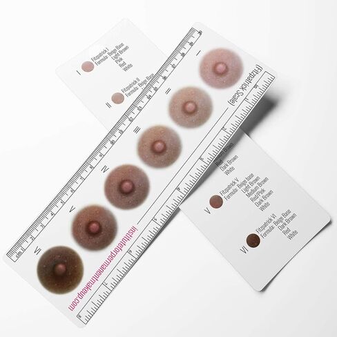 Breast Cancer Fitzpatrick Scale Areola Color Ruler in Saudi Arabia