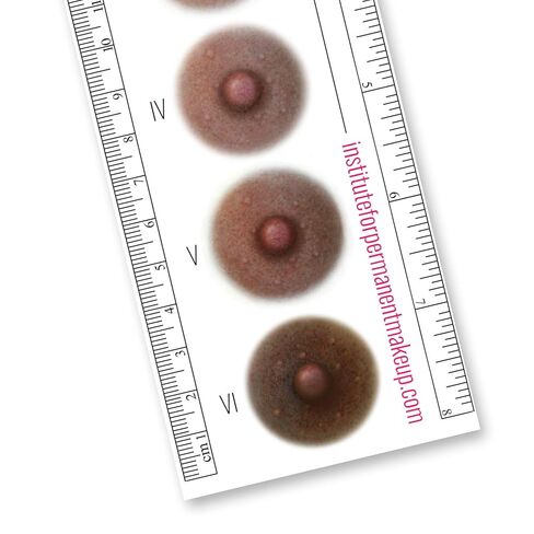 Breast Cancer Fitzpatrick Scale Areola Color Ruler in Saudi Arabia