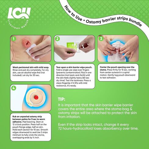 (45 قطعة) 20 شريطًا حاجزًا للفغرة + 25 منديلًا حاجزًا للبشرة | شرائط مضادة للحساسية وخالية من اللاتكس | لوازم الفغرة | مستلزمات فغر القولون | مناديل مبللة للبشرة اللطيفة | التغطية المستمرة in Kuwait