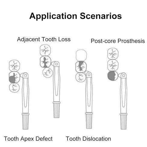 Dental Matrix Bands Orange Metal Restoration Matrix-Profecto Model with 180°Adjustable Retainer Dental Sectional Contoured Matrice Roll Type for Crownwork 24Pcs/Box in Saudi Arabia