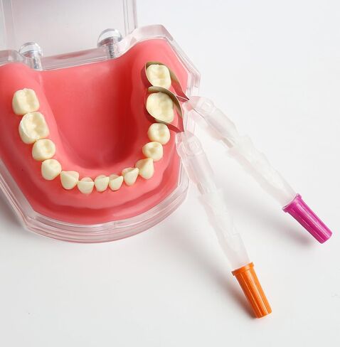 Dental Matrix Bands Orange Metal Restoration Matrix-Profecto Model with 180°Adjustable Retainer Dental Sectional Contoured Matrice Roll Type for Crownwork 24Pcs/Box in Saudi Arabia