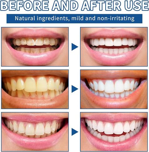 قطعتان من مسحوق تبييض الأسنان، مسحوق تبييض نفس منعش، إزالة البقع بدون حساسية، تأثيرات تبييض معززة (1) in Kuwait