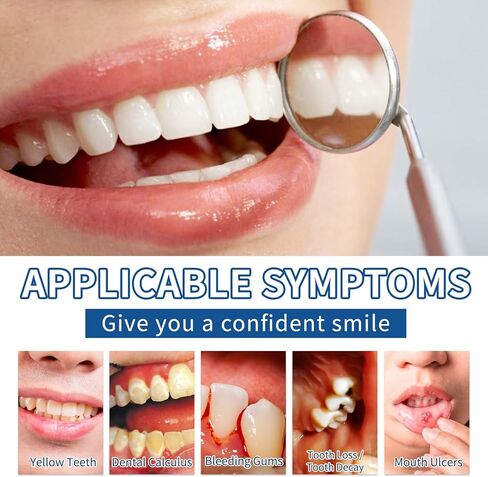 قطعتان من مسحوق تبييض الأسنان، مسحوق تبييض نفس منعش، إزالة البقع بدون حساسية، تأثيرات تبييض معززة (1) in Kuwait