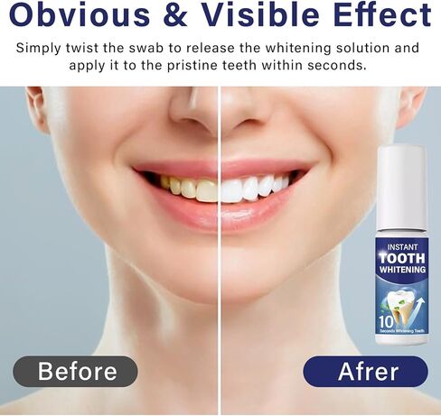 طلاء الأسنان لتفتيح الأسنان المحمولة - تغطية فورية للبقع - استعادة الابتسامة الواثقة in Kuwait