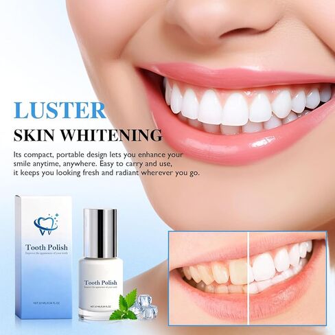 قطعتان من طلاء الأسنان، طلاء الأسنان، سائل تلميع الأسنان التجميلي لتحسين مظهر الأسنان، تركيبة الفرشاة، تركيبة آمنة محمولة للعناية بالفم ونتائج طويلة الأمد in Kuwait
