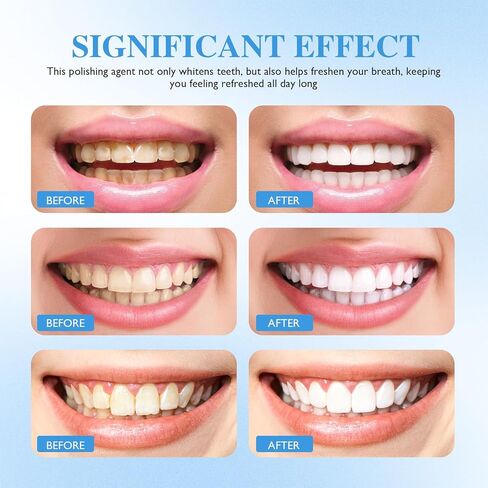 قطعتان من طلاء الأسنان، طلاء الأسنان، سائل تلميع الأسنان التجميلي لتحسين مظهر الأسنان، تركيبة الفرشاة، تركيبة آمنة محمولة للعناية بالفم ونتائج طويلة الأمد in Kuwait