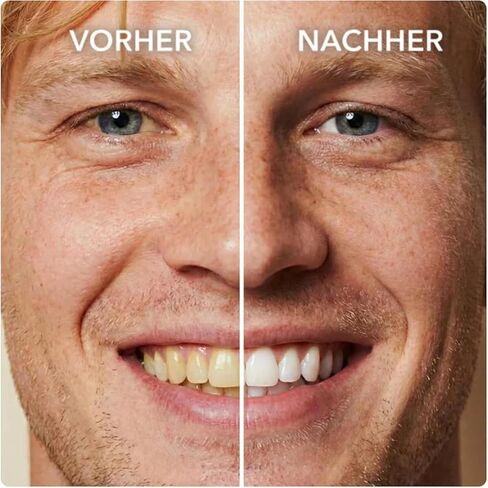 Instant Whitening Tooth Paint, Tooth Polish White, Enhance Tooth Surface Appearance, 2 Pack in Kuwait