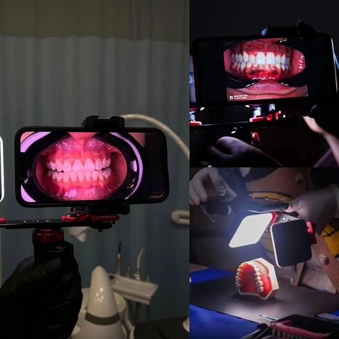 Dental Filling Light, Oral LED Photography Equipment, Brightness Adjustment Fill Light for Dentist Treatment(MK-016+37mm CPL) in Saudi Arabia