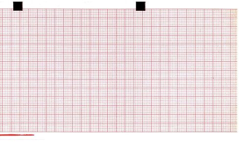 ورق تخطيط القلب 80 مم × 70 مم × 300 ورقة (يعمل مع SCHILLER AT101، 2157026، 9690029300، ARGUS LCM، DEFIGARD، SECA CT 8000i، P8000/8000I) (10) in Kuwait