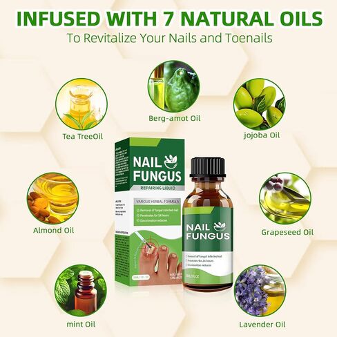 Toenail Fungus Treatment Extra Strength,7Days Nail FungusTreatment for Toenail,7 Pure Natural Plant Extracts,ToeNail Fungus Treatments for Thick, Broken, Discolored & Damaged Nail 1 Fl Oz (Pack of 1) in Saudi Arabia