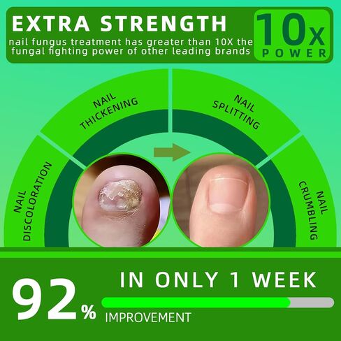 Toenail Fungus Treatment Extra Strength,7Days Nail FungusTreatment for Toenail,7 Pure Natural Plant Extracts,ToeNail Fungus Treatments for Thick, Broken, Discolored & Damaged Nail 1 Fl Oz (Pack of 1) in Saudi Arabia