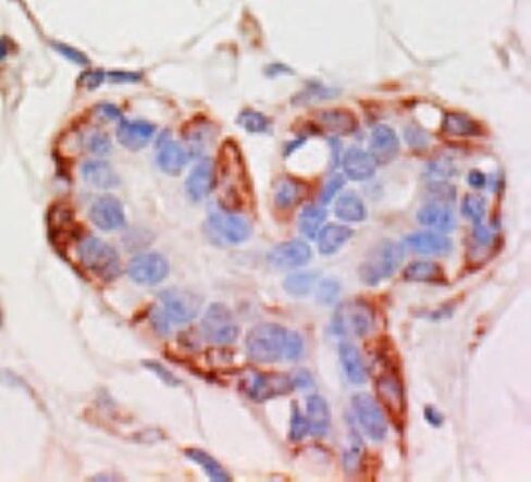 مجموعة IHC هيماتوكسيلين المضادة للبقع (300 اختبار) in Saudi Arabia