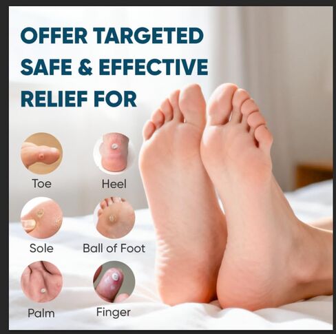 وسادات إزالة الذرة 96P للقدمين وأصابع القدم، قوة إضافية 40% رقع طبية من حمض الساليسيليك، علاج فعال لمسامير القدم الصغيرة والجلد الميت in Kuwait