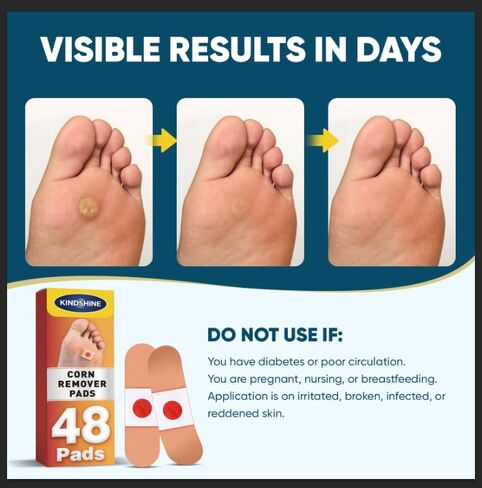 وسادات إزالة الذرة 96P للقدمين وأصابع القدم، قوة إضافية 40% رقع طبية من حمض الساليسيليك، علاج فعال لمسامير القدم الصغيرة والجلد الميت in Kuwait