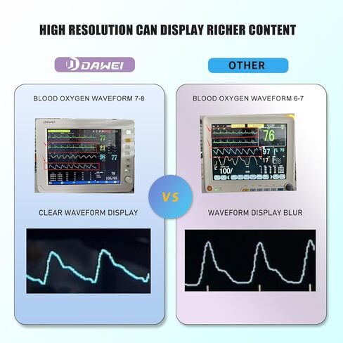 DAWEI 12.1" Veterinary Vital Signs Monitor for Pets, Veterinary Monitor for Animal ECG, SpO2, Blood Pressure, Respiration & Temperature Monitoring for Dog, Cat and Small Animals in Kuwait