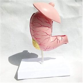Medical Anatomy Model of Digestive System in Human Gastric Diseases in Kuwait