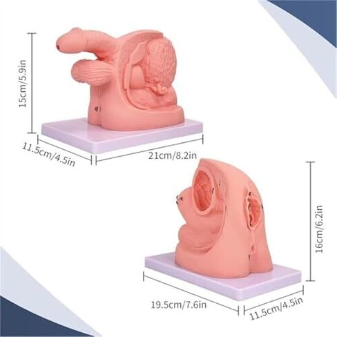 Male and Female Genital Duct Models Suitable for Clinical Teaching in Medicine. in Kuwait