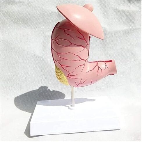 Medical Anatomy Model of Digestive System in Human Gastric Diseases in Kuwait