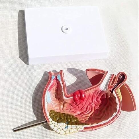Medical Anatomy Model of Digestive System in Human Gastric Diseases in Kuwait