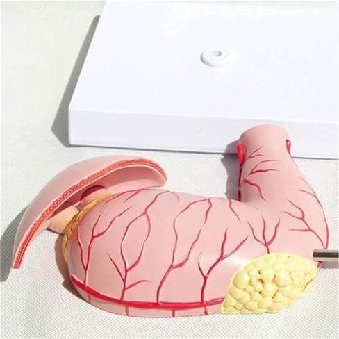 Medical Anatomy Model of Digestive System in Human Gastric Diseases in Kuwait
