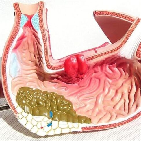 Medical Anatomy Model of Digestive System in Human Gastric Diseases in Kuwait