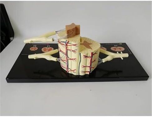 Spinal Slice Model, 5X Life Size, Spinal Ganglia and Blood Vessels Used for Teaching in Kuwait