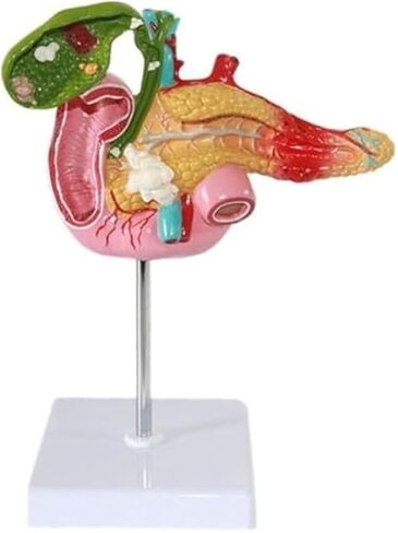 1:1 البنكرياس البشري الطحال الاثني عشر المرارة نموذج تشريحي مرضي للتدريب الطبي والعلاج الطبي المساعد in Kuwait