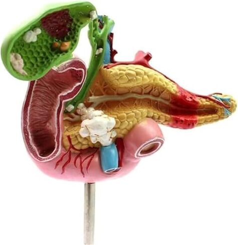 1:1 البنكرياس البشري الطحال الاثني عشر المرارة نموذج تشريحي مرضي للتدريب الطبي والعلاج الطبي المساعد in Kuwait