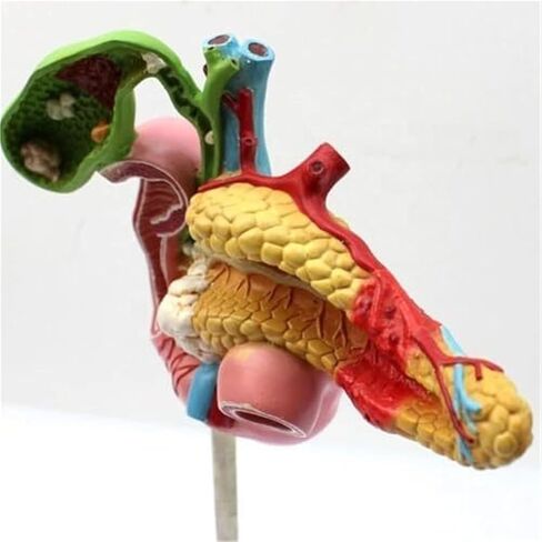 1:1 البنكرياس البشري الطحال الاثني عشر المرارة نموذج تشريحي مرضي للتدريب الطبي والعلاج الطبي المساعد in Kuwait