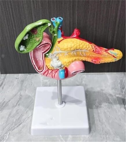 1:1 البنكرياس البشري الطحال الاثني عشر المرارة نموذج تشريحي مرضي للتدريب الطبي والعلاج الطبي المساعد in Kuwait