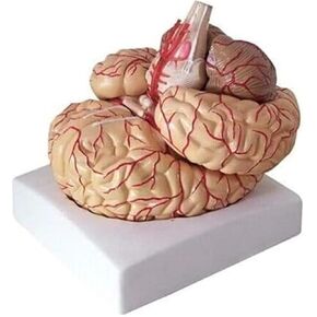 Anatomy of The Human Brain and Cerebral Artery Model in Kuwait