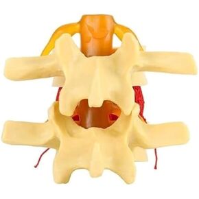 Degenerative Changes in The Human Lumbar Spine and Anatomical Lumbar Spine Model in Kuwait