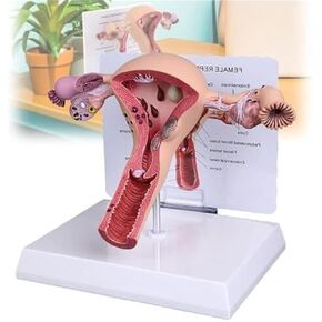 Female Reproductive Organs, Pathological Uterus, Human Anatomy Models, School Teaching Demonstration Tools in Kuwait