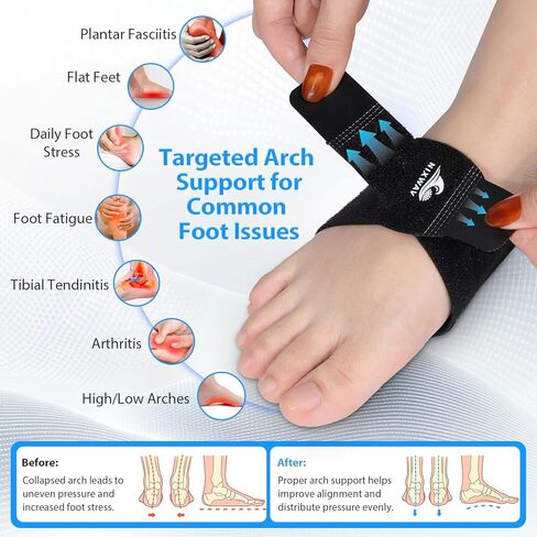 Arch Support Braces (10PCS) for Plantar Fasciitis Relief, Adjustable Compression Bands with 3-Level Height, Gel Pads & Replaceable Inserts, Arch Support Inserts Women & Men for Flat Feet, High & Fallen Arches (Black, One Size) in Saudi Arabia