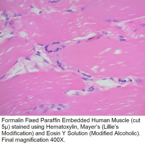 محلول الأيوسين واي (كحولي معدل)، 1 جالون in Kuwait