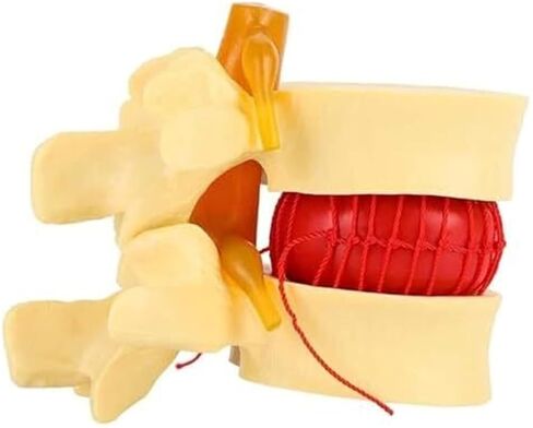 التغيرات التنكسية في العمود الفقري القطني البشري ونموذج العمود الفقري القطني التشريحي in Kuwait