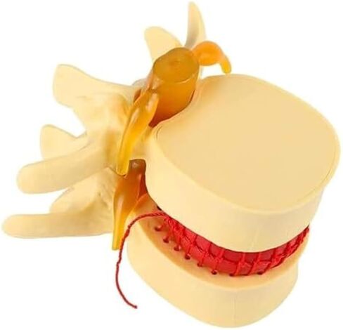 التغيرات التنكسية في العمود الفقري القطني البشري ونموذج العمود الفقري القطني التشريحي in Kuwait