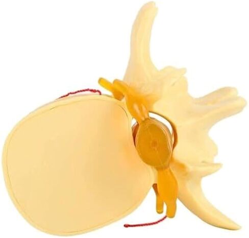 التغيرات التنكسية في العمود الفقري القطني البشري ونموذج العمود الفقري القطني التشريحي in Kuwait