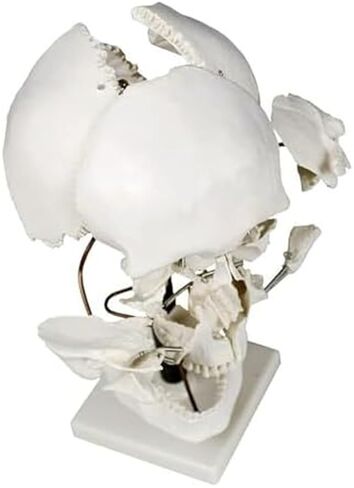 Teaching Anatomy of 17 Separated Human Skull Models in Kuwait