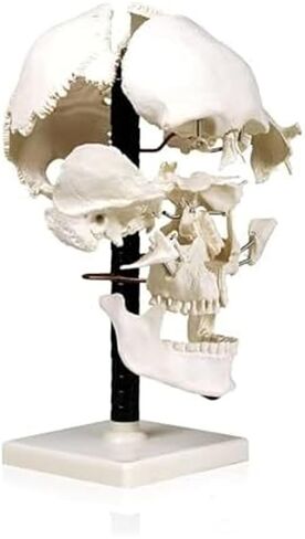 Teaching Anatomy of 17 Separated Human Skull Models in Kuwait