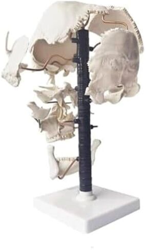 Teaching Anatomy of 17 Separated Human Skull Models in Kuwait