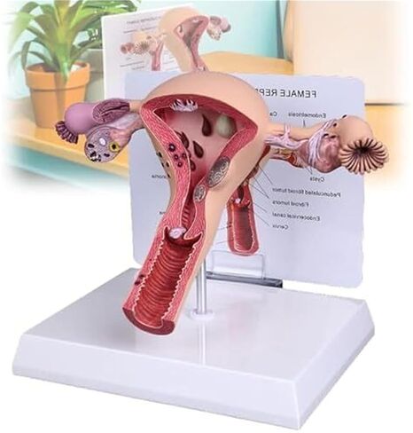 Female Reproductive Organs, Pathological Uterus, Human Anatomy Models, School Teaching Demonstration Tools in Kuwait
