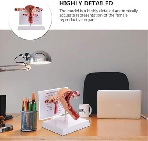 Female Reproductive Organs, Pathological Uterus, Human Anatomy Models, School Teaching Demonstration Tools in Kuwait