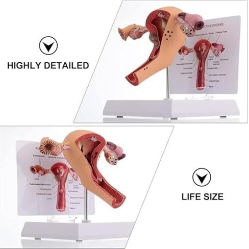 Female Reproductive Organs, Pathological Uterus, Human Anatomy Models, School Teaching Demonstration Tools in Kuwait